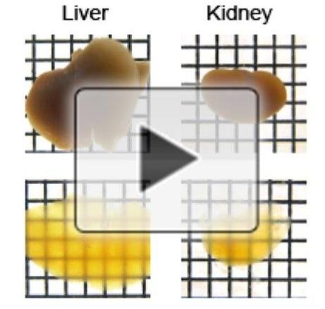 Making organs transparent to improve nanomedicine (video) image