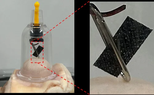On the left, a clear bell-shaped jar suctioned onto a square of pig skin. Inside the top of the jar is a stopper holding a black rectangle. Two leader lines extend to a zoomed-in image of the black rectangle in a tweezer-like clip on the right. 