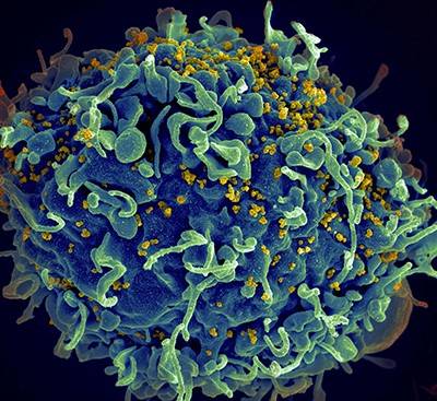 Microscopic image of HIV, depicted by yellow dots, infecting a human T cell
