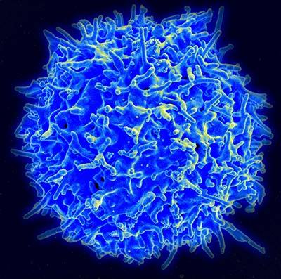 Micrograph of healthy T cell, a spherical cell with some spiky surface irregularities