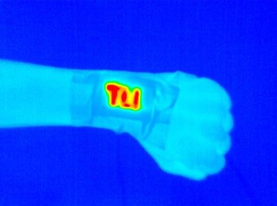 Infrared image of active wristband heater 