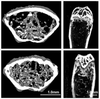 Four micro-computed tomography images of a segment of a femur, taken from two different views, pictured on a one-millimeter scale. The untreated bone looks sparse in the middle, whereas the treated group has more shading, indicating bone material.