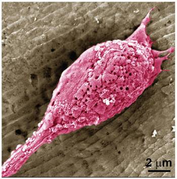 Muscle cells visualized in magenta growing on a ridge-patterned film. The cell is wider than a two-micrometer scale bar.
