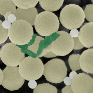 A scanning electron microscope image of light yellow microrobot spheres clumped together. Attached to the yellow spheres are green squiggles of bacteria and small gray polystyrene beads.