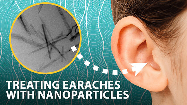 Treating earaches with nanoparticles that generate antiseptic on demand image