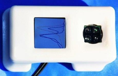 Cellphone-sized device quickly detects the Ebola virus image