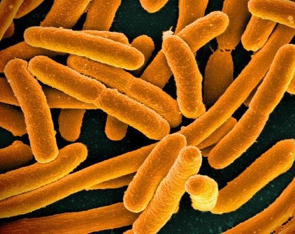 Speedy bacteria detector could help prevent foodborne illnesses image