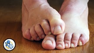 Why Feet Smell (And What to Do About It) image