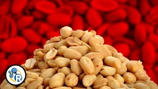 Why Are People Allergic To Peanuts? image
