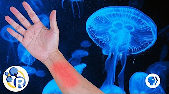 Should You Pee on a Jellyfish Sting? image